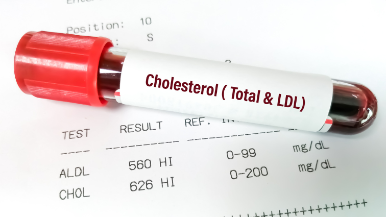 cholesterol