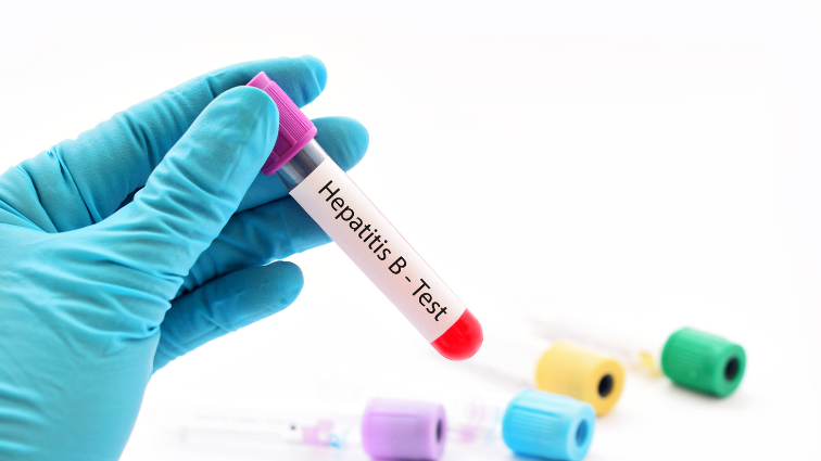 test hepatitída B